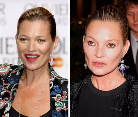 kate moss plastic surgery fendi|Kate Moss' Journey: Navigating Beauty Standards and Plastic .